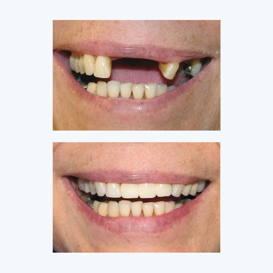 MONTERO SMILE ART - MONTERO SMILE ART