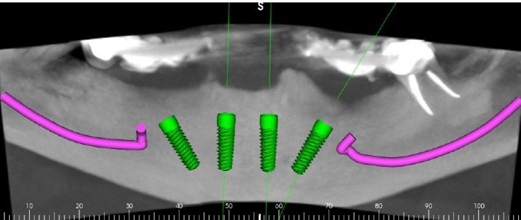 MONTERO SMILE ART - MONTERO SMILE ART