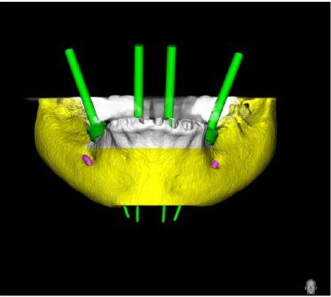 MONTERO SMILE ART - MONTERO SMILE ART