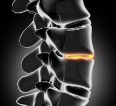 Montgomery County Chiropractic Center - Montgomery County Chiropractic Center