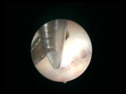 Mr Ioannis Douliotis MBBS MRCOG DFFP - Mr Ioannis Douliotis MBBS MRCOG DFFP