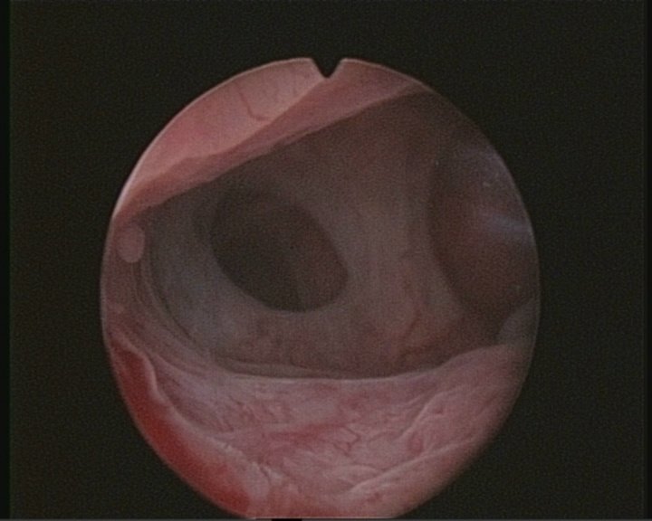 Mr Ioannis Douliotis MBBS MRCOG DFFP - Mr Ioannis Douliotis MBBS MRCOG DFFP