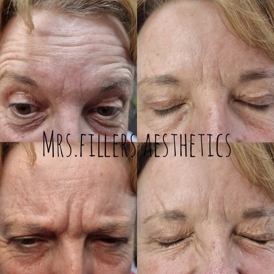 Mr. & Mrs. Fillers Aesthetics - Mr. & Mrs. Fillers Aesthetics