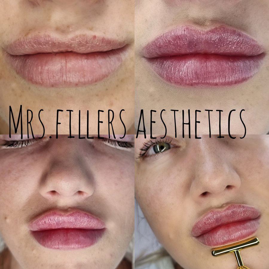 Mr. & Mrs. Fillers Aesthetics - Mr. & Mrs. Fillers Aesthetics