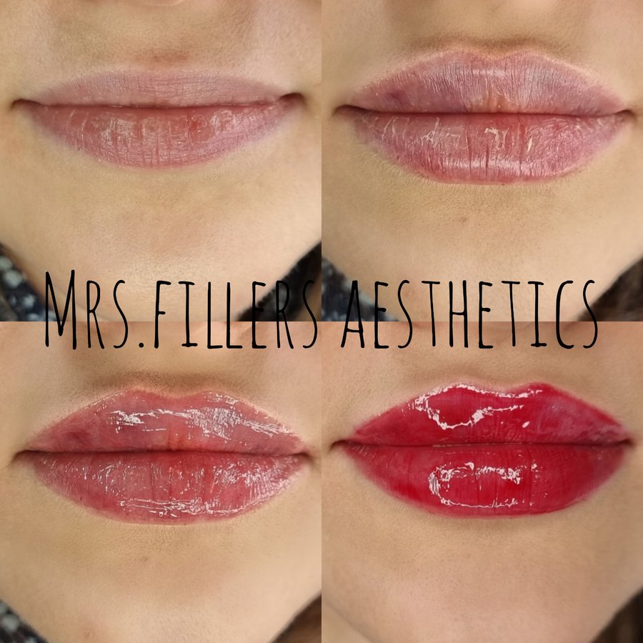 Mr. & Mrs. Fillers Aesthetics - Mr. & Mrs. Fillers Aesthetics