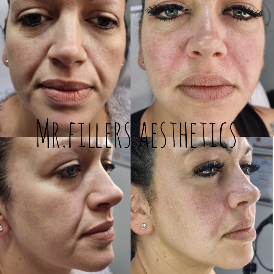 Mr. & Mrs. Fillers Aesthetics - Mr. & Mrs. Fillers Aesthetics