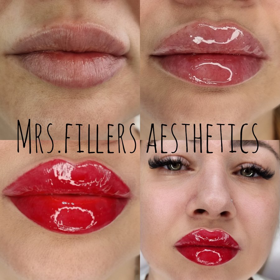 Mr. & Mrs. Fillers Aesthetics - Mr. & Mrs. Fillers Aesthetics
