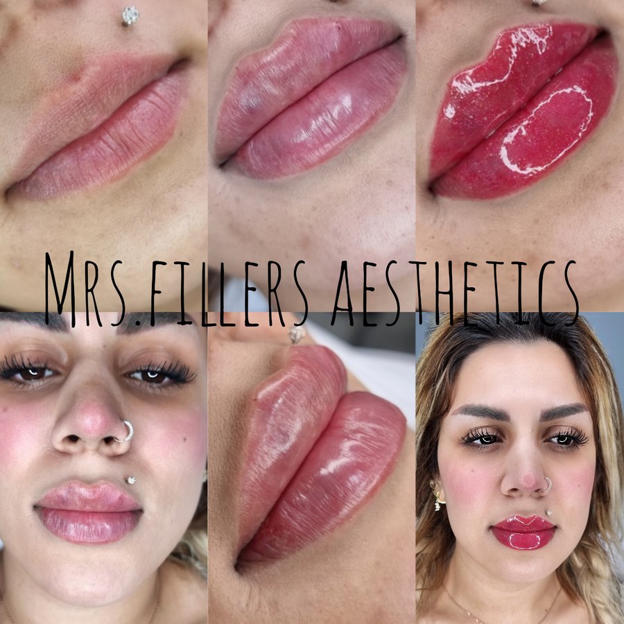 Mr. & Mrs. Fillers Aesthetics - Mr. & Mrs. Fillers Aesthetics