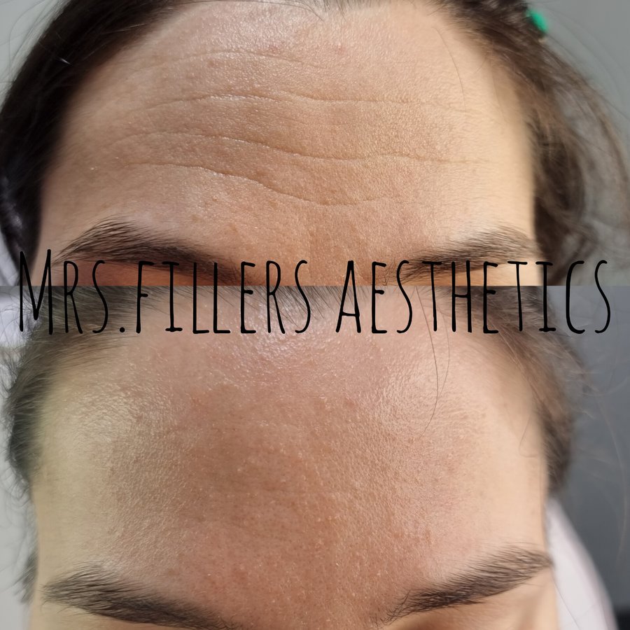Mr. & Mrs. Fillers Aesthetics - Mr. & Mrs. Fillers Aesthetics