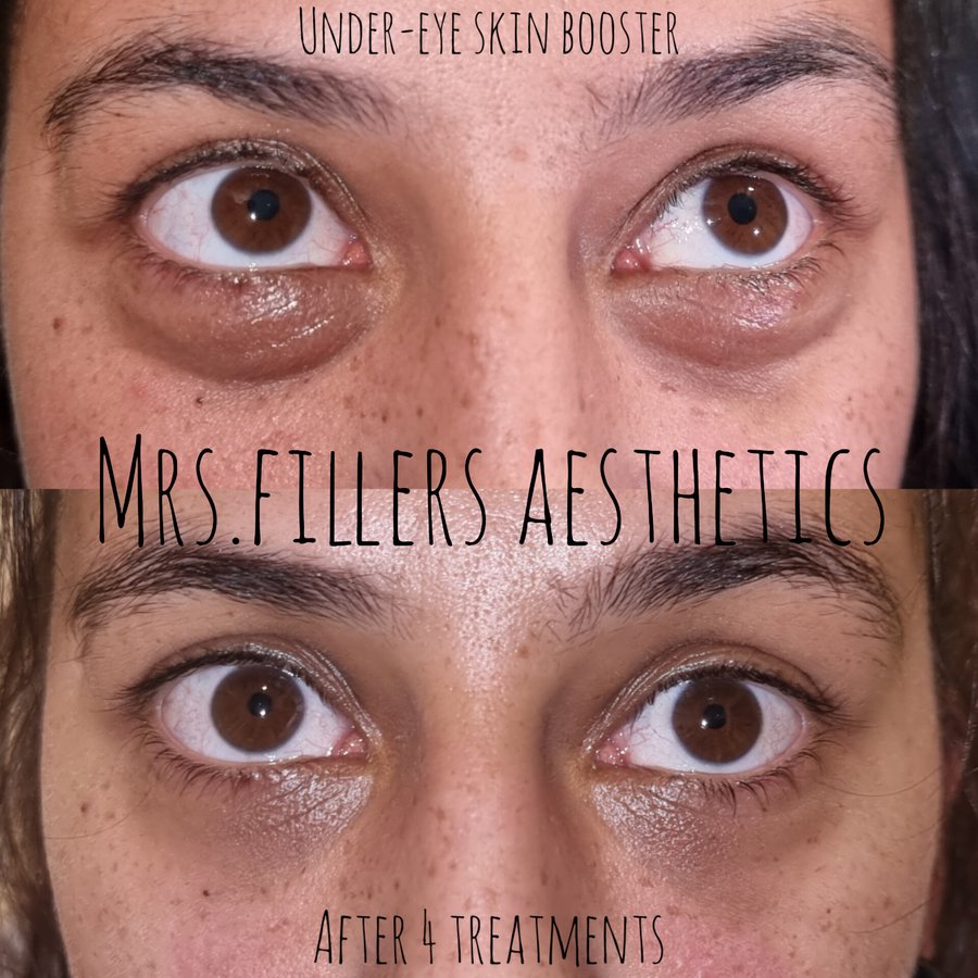 Mr. & Mrs. Fillers Aesthetics - Mr. & Mrs. Fillers Aesthetics