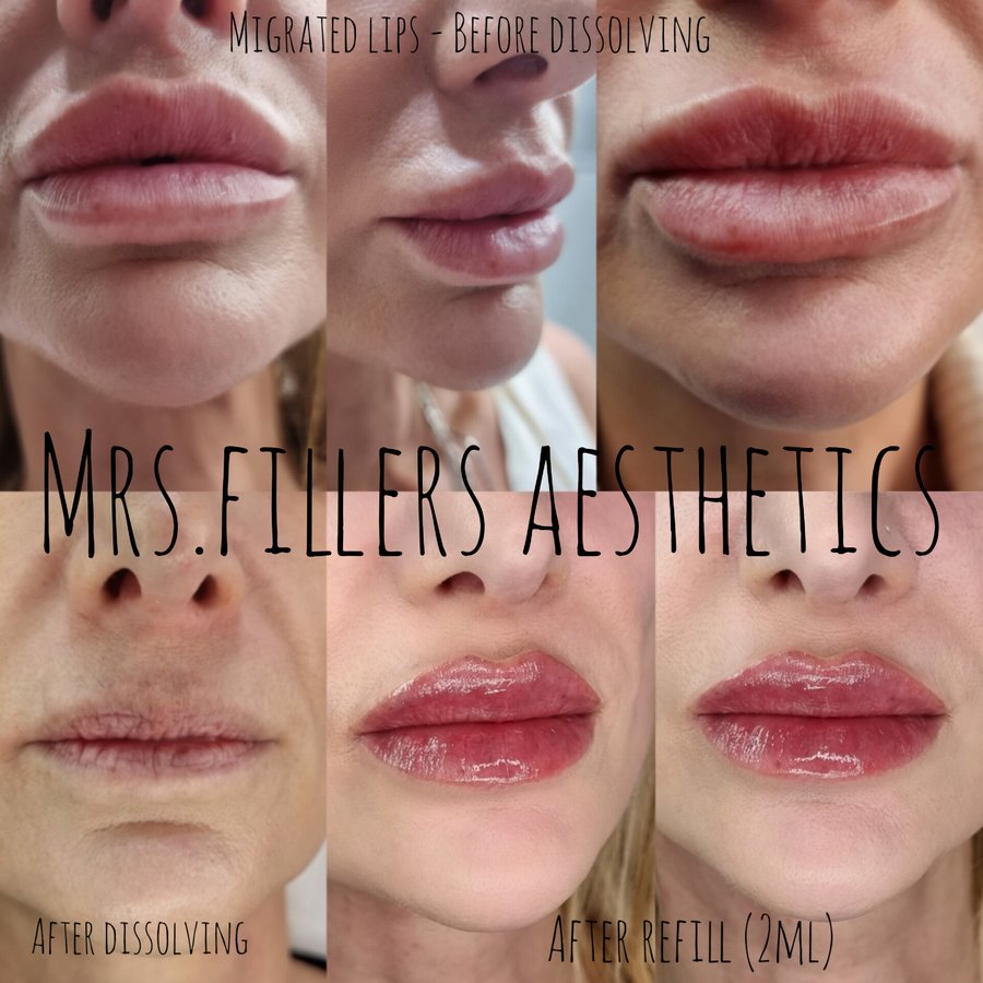 Mr. & Mrs. Fillers Aesthetics - Mr. & Mrs. Fillers Aesthetics
