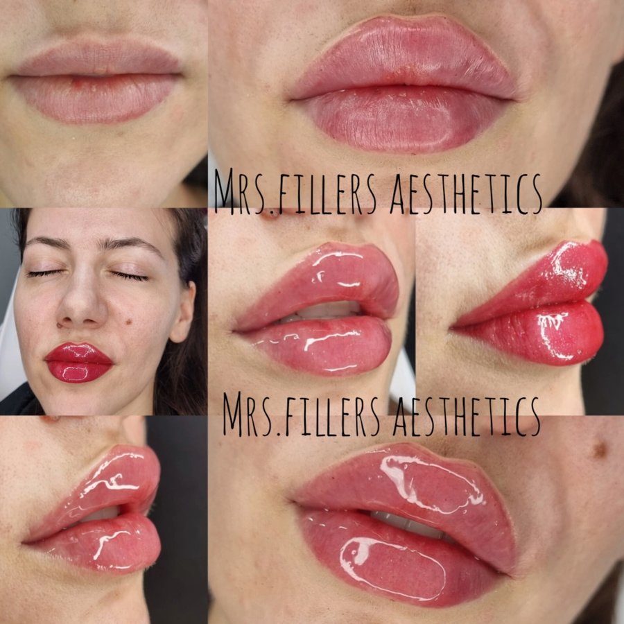 Mr. & Mrs. Fillers Aesthetics - Mr. & Mrs. Fillers Aesthetics