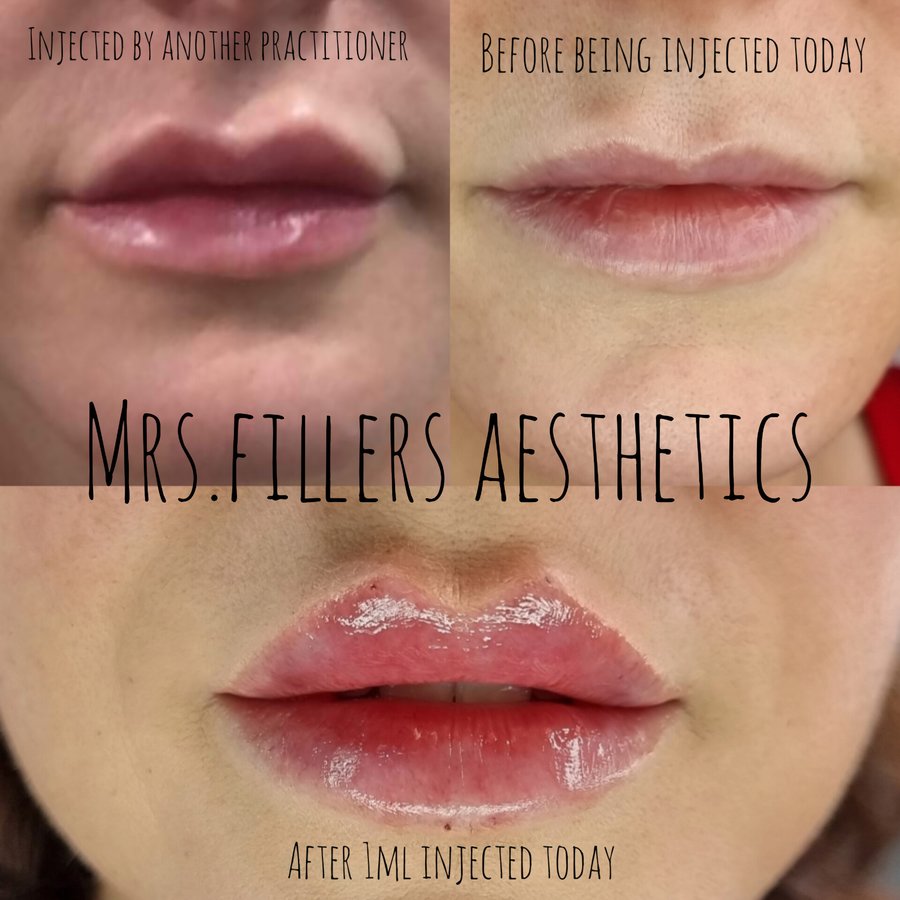 Mr. & Mrs. Fillers Aesthetics - Mr. & Mrs. Fillers Aesthetics