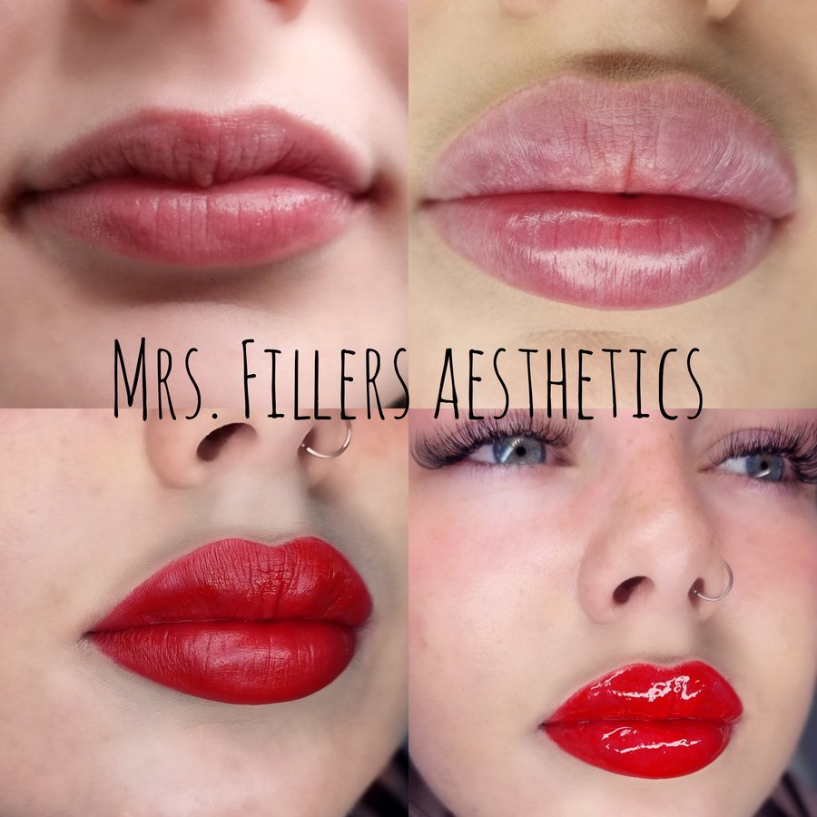 Mr. & Mrs. Fillers Aesthetics - Mr. & Mrs. Fillers Aesthetics