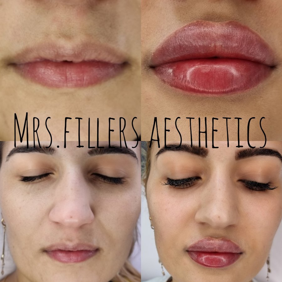 Mr. & Mrs. Fillers Aesthetics - Mr. & Mrs. Fillers Aesthetics