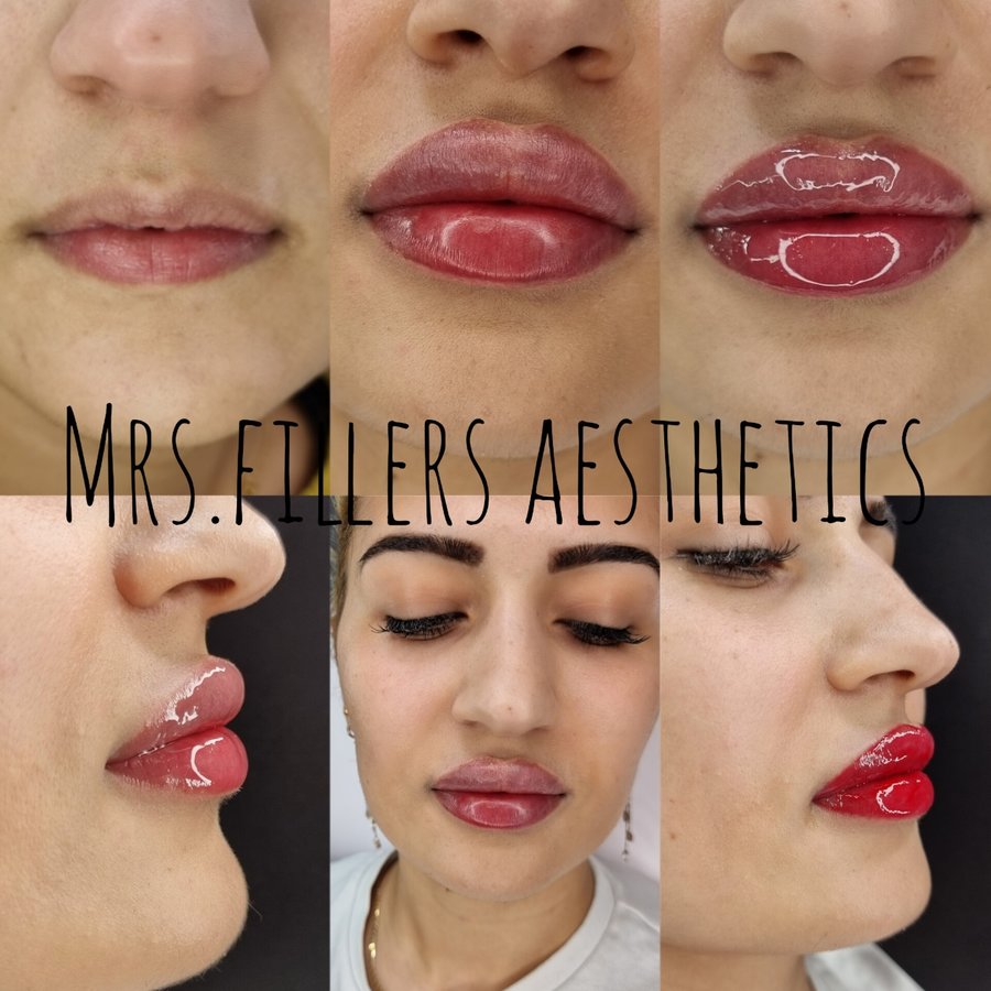 Mr. & Mrs. Fillers Aesthetics - Mr. & Mrs. Fillers Aesthetics