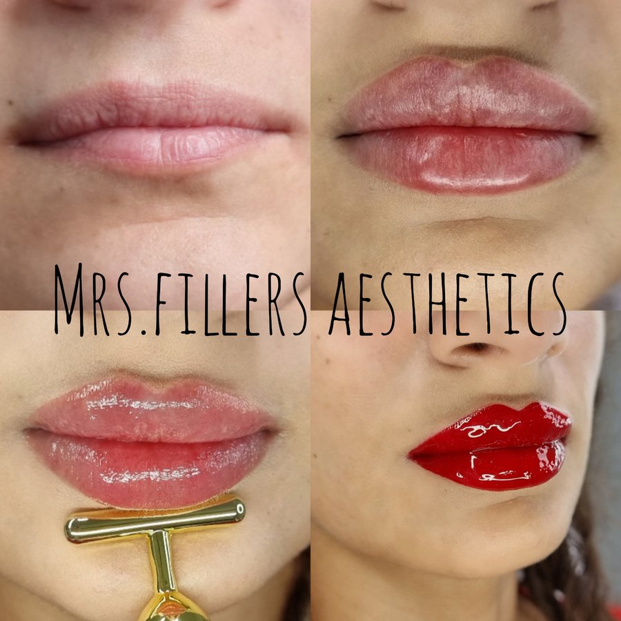 Mr. & Mrs. Fillers Aesthetics - Mr. & Mrs. Fillers Aesthetics