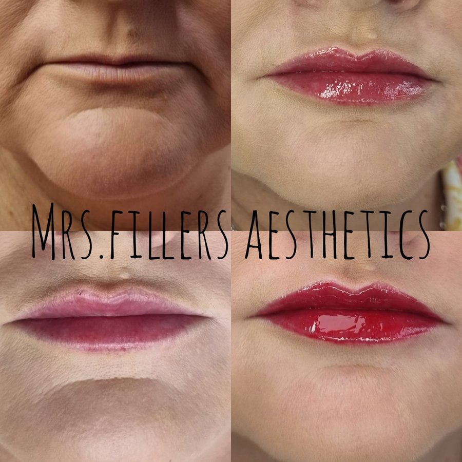 Mr. & Mrs. Fillers Aesthetics - Mr. & Mrs. Fillers Aesthetics