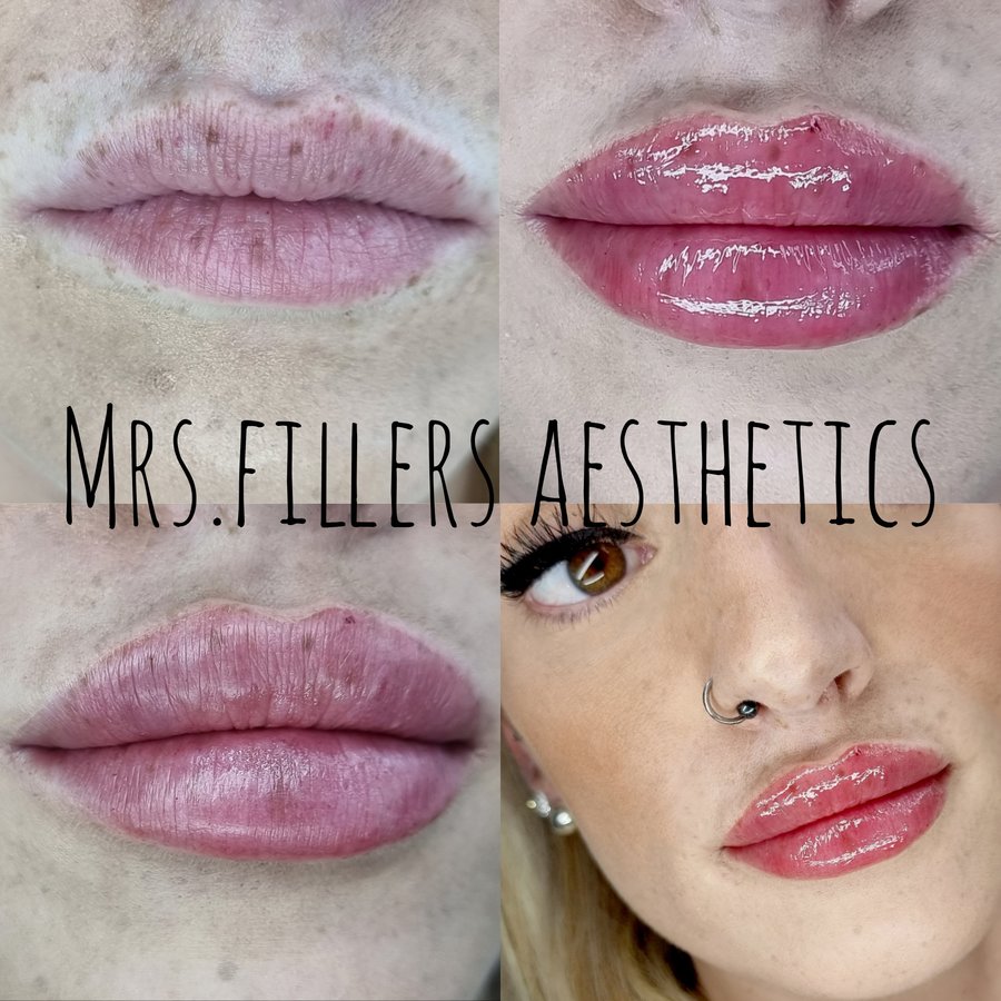 Mr. & Mrs. Fillers Aesthetics - Mr. & Mrs. Fillers Aesthetics
