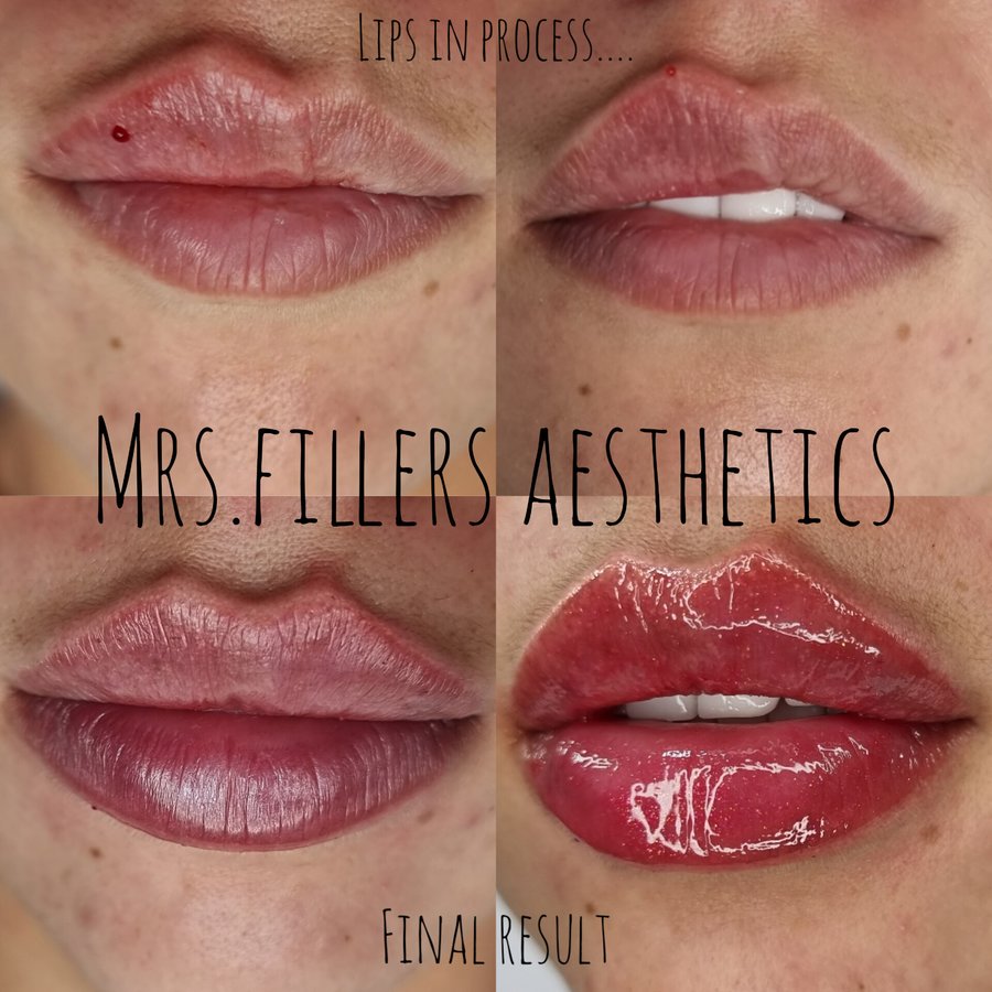 Mr. & Mrs. Fillers Aesthetics - Mr. & Mrs. Fillers Aesthetics