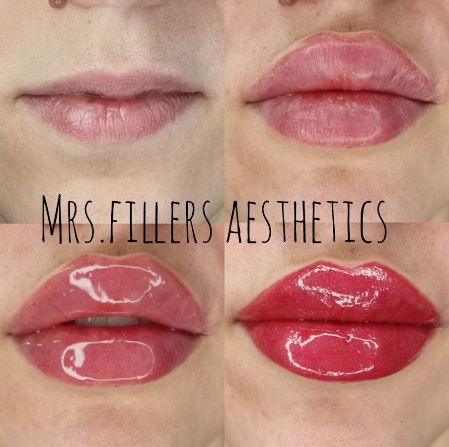 Mr. & Mrs. Fillers Aesthetics - Mr. & Mrs. Fillers Aesthetics