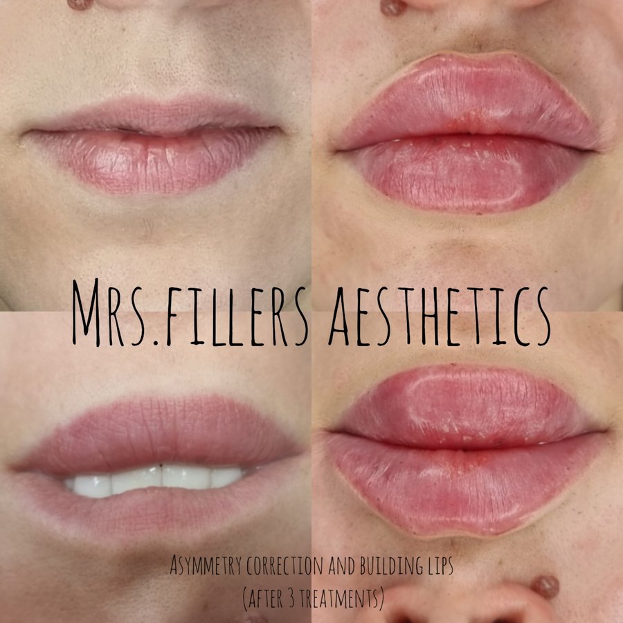 Mr. & Mrs. Fillers Aesthetics - Mr. & Mrs. Fillers Aesthetics