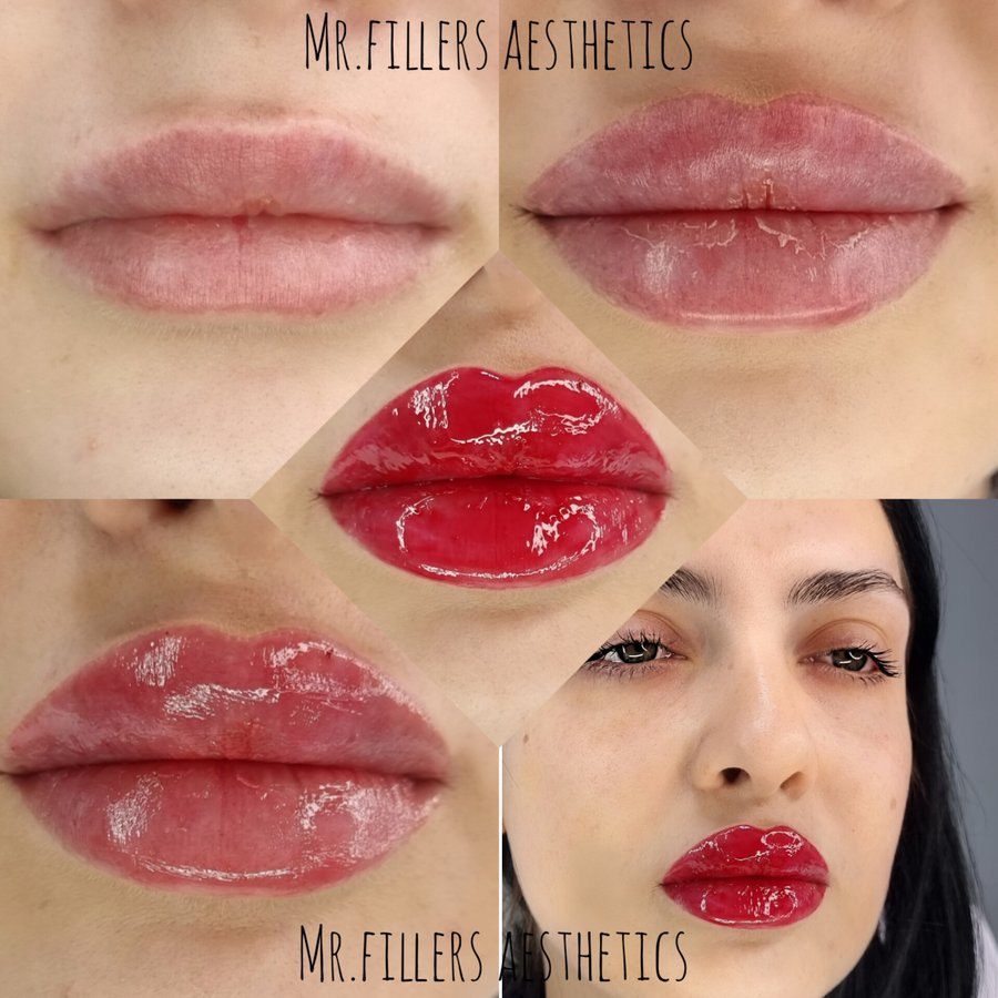 Mr. & Mrs. Fillers Aesthetics - Mr. & Mrs. Fillers Aesthetics