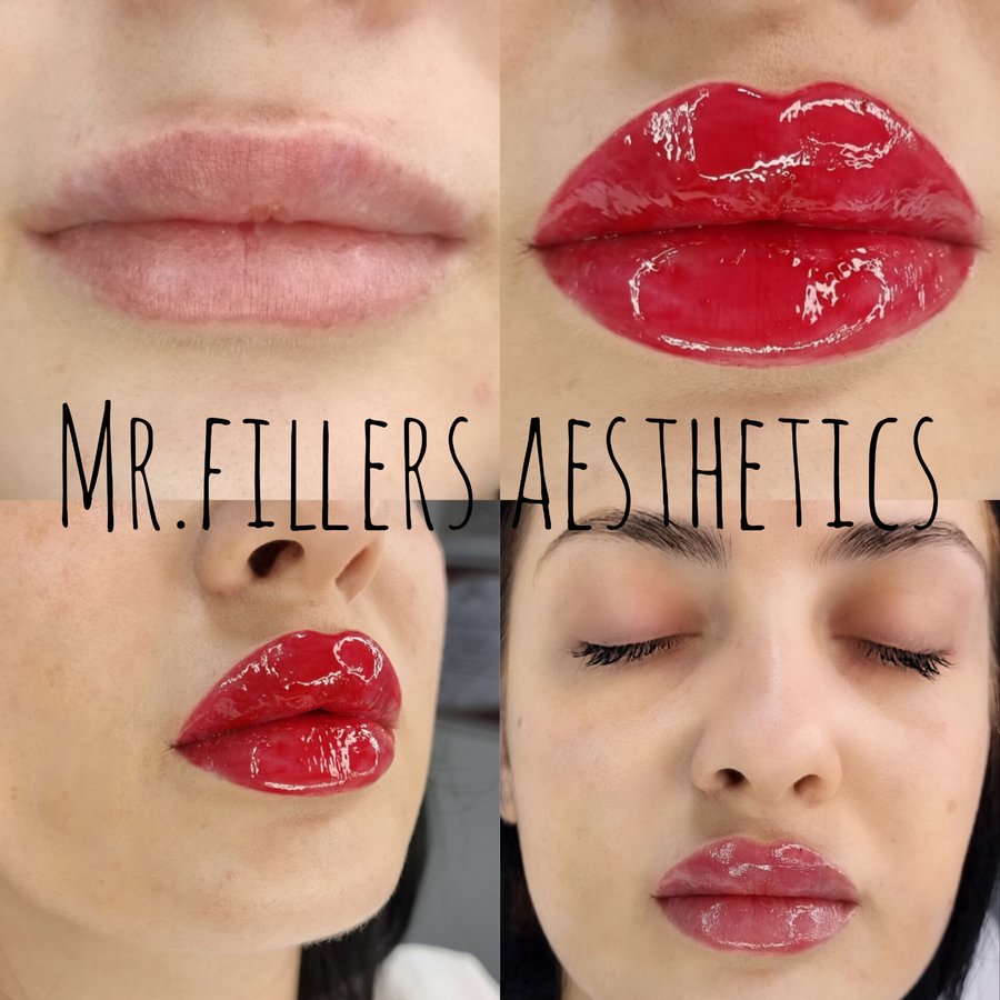 Mr. & Mrs. Fillers Aesthetics - Mr. & Mrs. Fillers Aesthetics