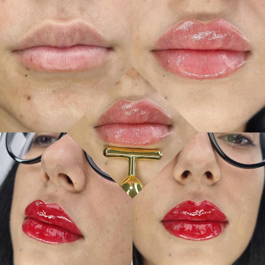 Mr. & Mrs. Fillers Aesthetics - Mr. & Mrs. Fillers Aesthetics