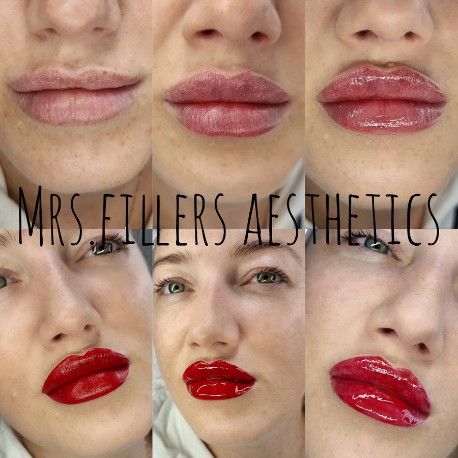 Mr. & Mrs. Fillers Aesthetics - Mr. & Mrs. Fillers Aesthetics