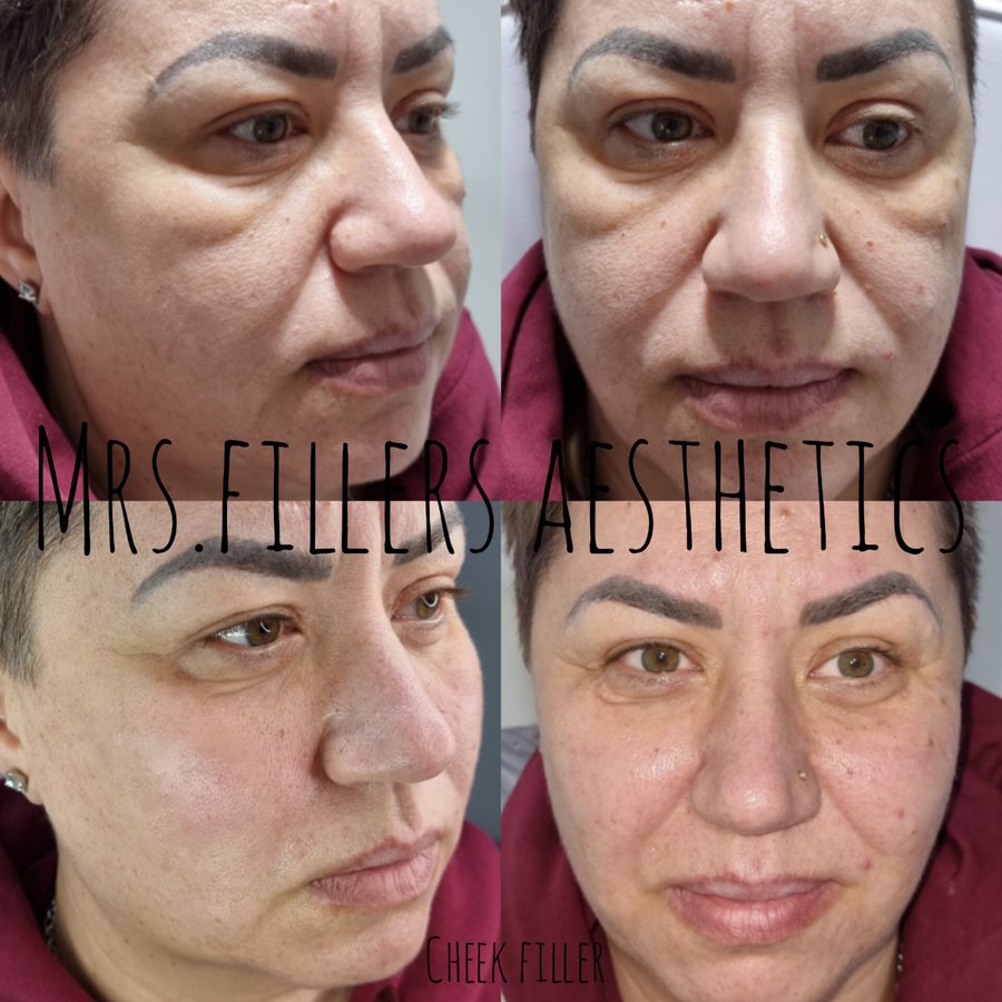 Mr. & Mrs. Fillers Aesthetics - Mr. & Mrs. Fillers Aesthetics