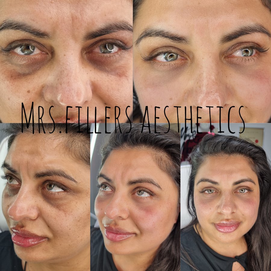 Mr. & Mrs. Fillers Aesthetics - Mr. & Mrs. Fillers Aesthetics