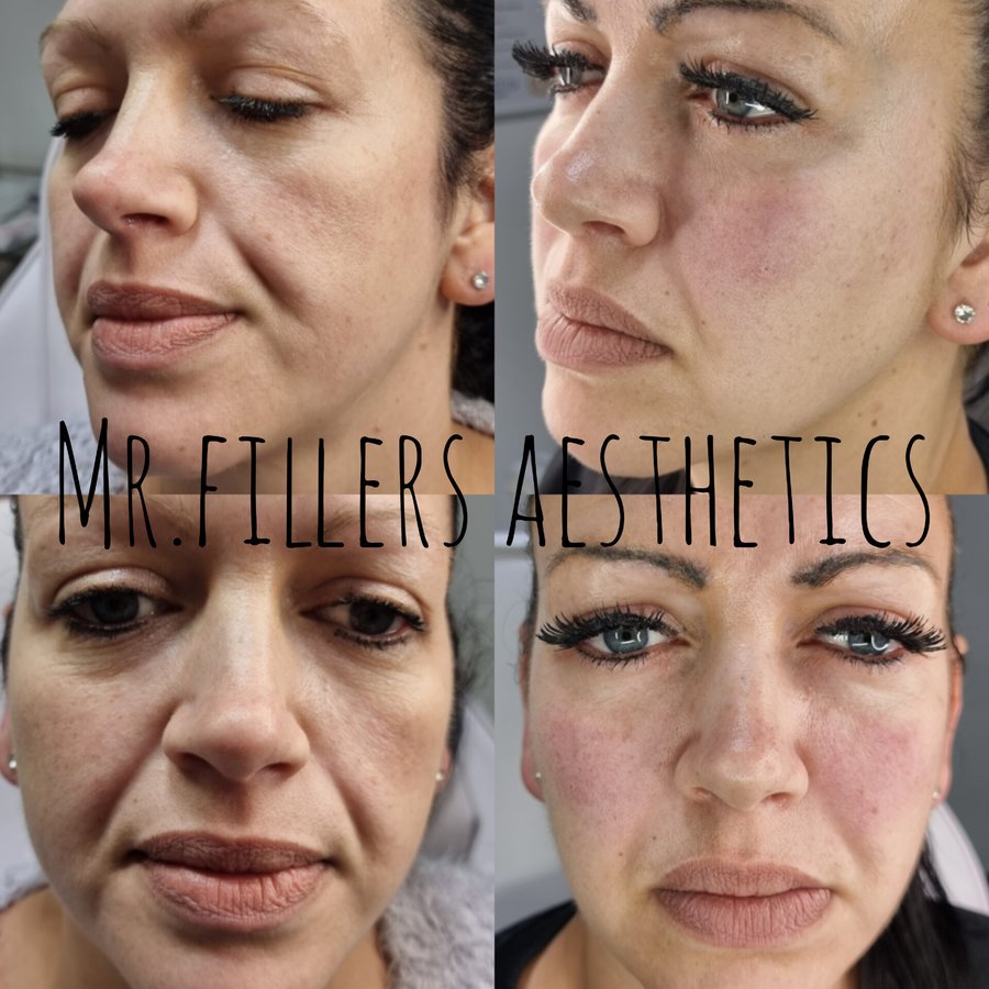 Mr. & Mrs. Fillers Aesthetics - Mr. & Mrs. Fillers Aesthetics
