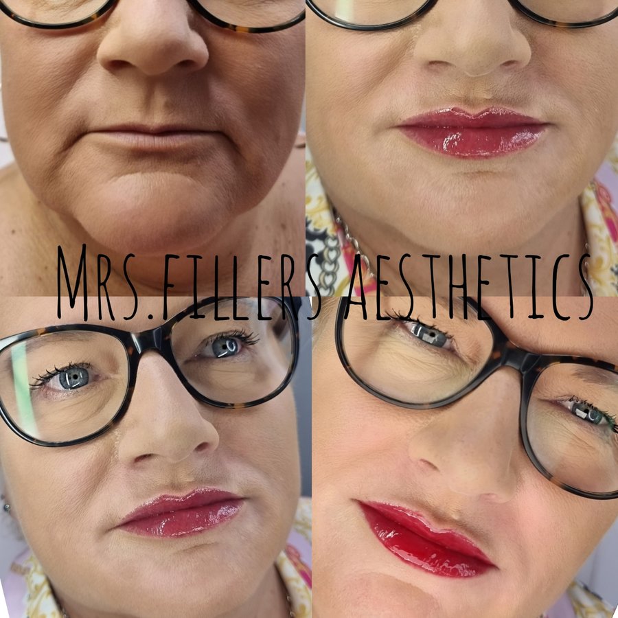 Mr. & Mrs. Fillers Aesthetics - Mr. & Mrs. Fillers Aesthetics