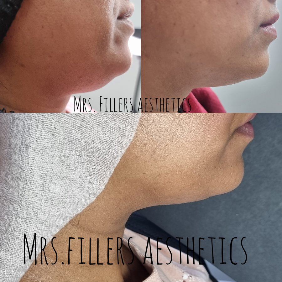 Mr. & Mrs. Fillers Aesthetics - Mr. & Mrs. Fillers Aesthetics