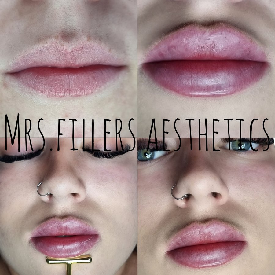 Mr. & Mrs. Fillers Aesthetics - Mr. & Mrs. Fillers Aesthetics