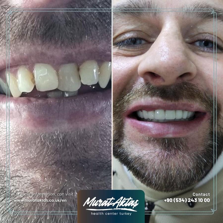 Murat Aktas Health Center Turkey - Murat Aktas Health Center Turkey