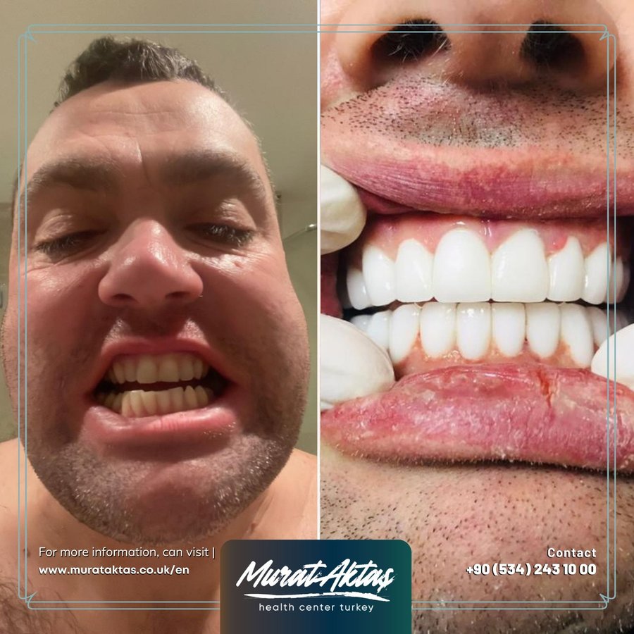 Murat Aktas Health Center Turkey - Murat Aktas Health Center Turkey