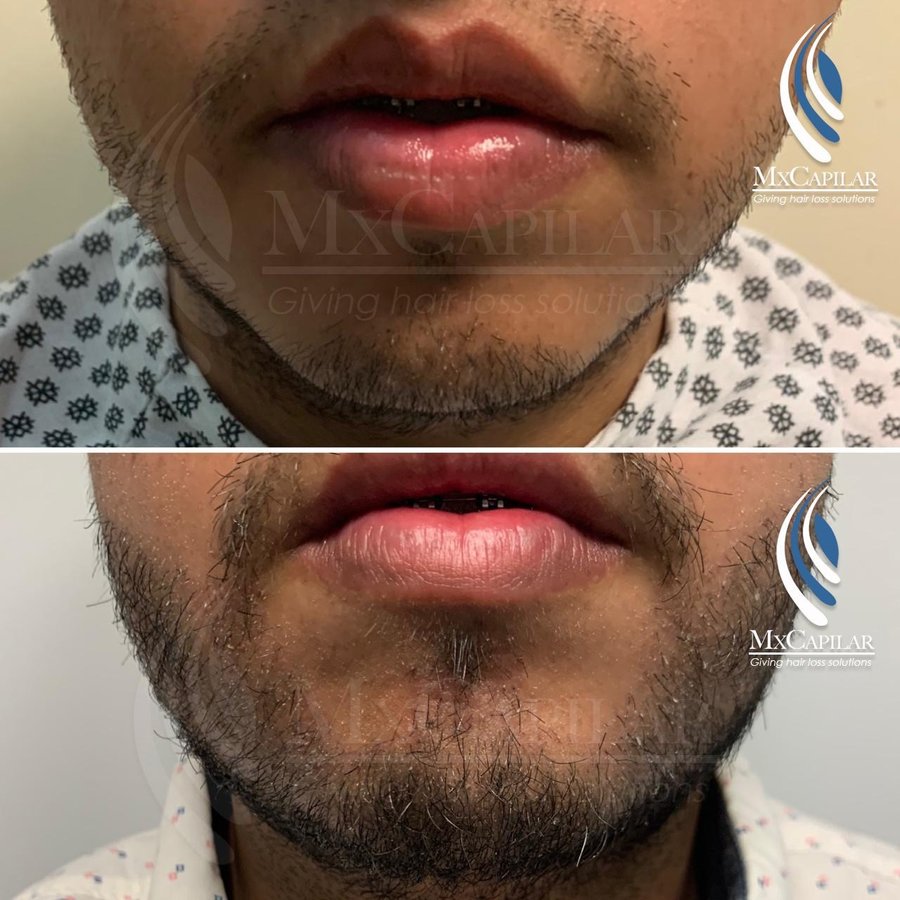 MX Capilar Tijuana - MX Capilar Tijuana