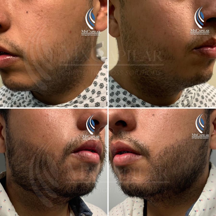 MX Capilar Tijuana - MX Capilar Tijuana