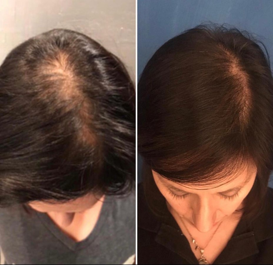 MX Capilar Tijuana - MX Capilar Tijuana