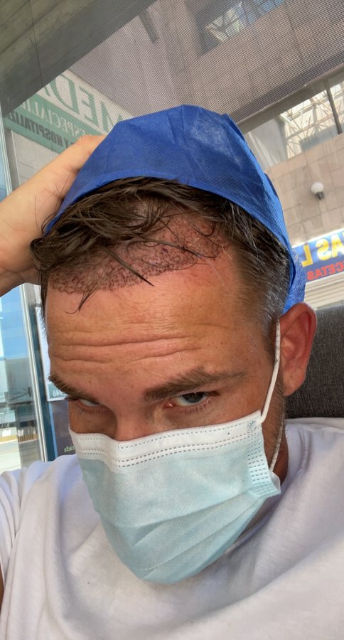 MX Capilar Tijuana - MX Capilar Tijuana