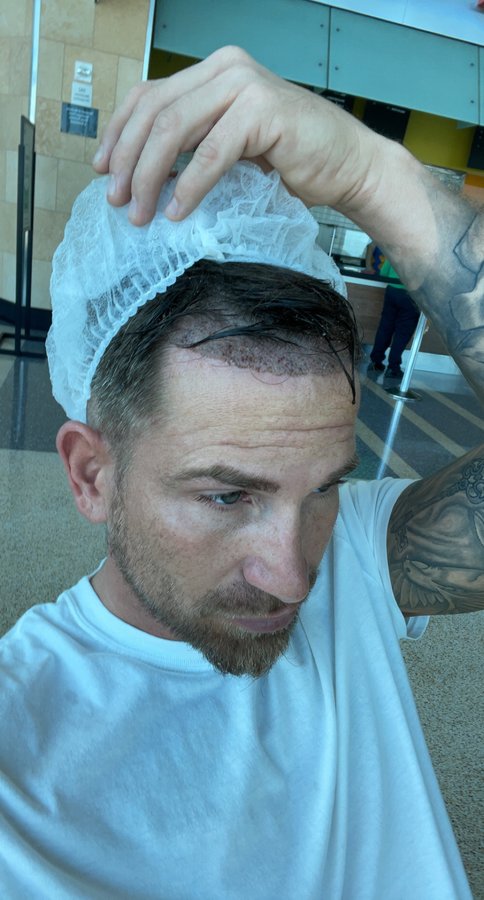 MX Capilar Tijuana - MX Capilar Tijuana