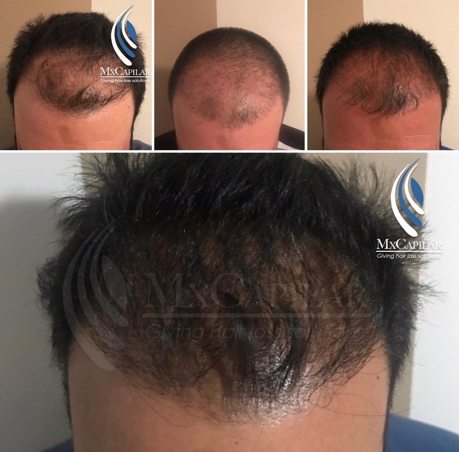 MX Capilar Tijuana - MX Capilar Tijuana