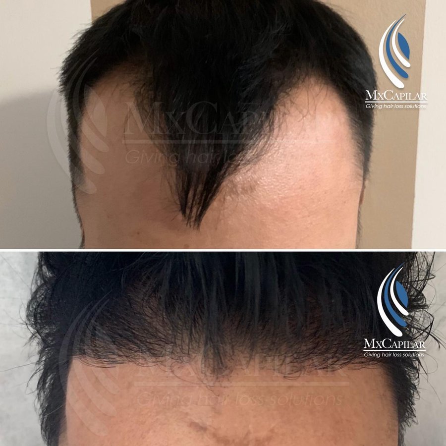 MX Capilar Tijuana - MX Capilar Tijuana