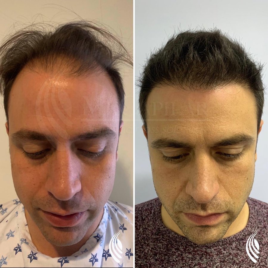 MX Capilar Tijuana - MX Capilar Tijuana