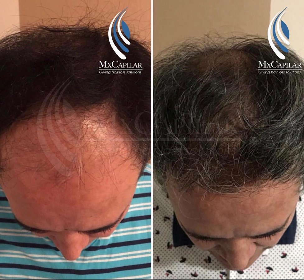 MX Capilar Tijuana - MX Capilar Tijuana