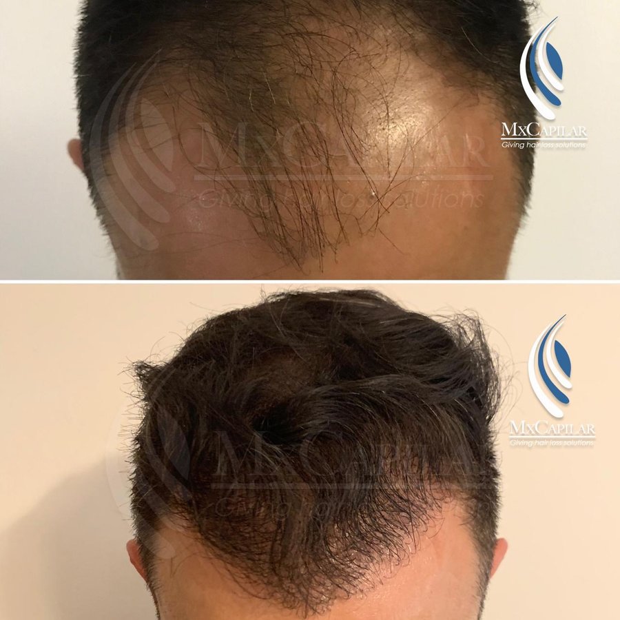 MX Capilar Tijuana - MX Capilar Tijuana