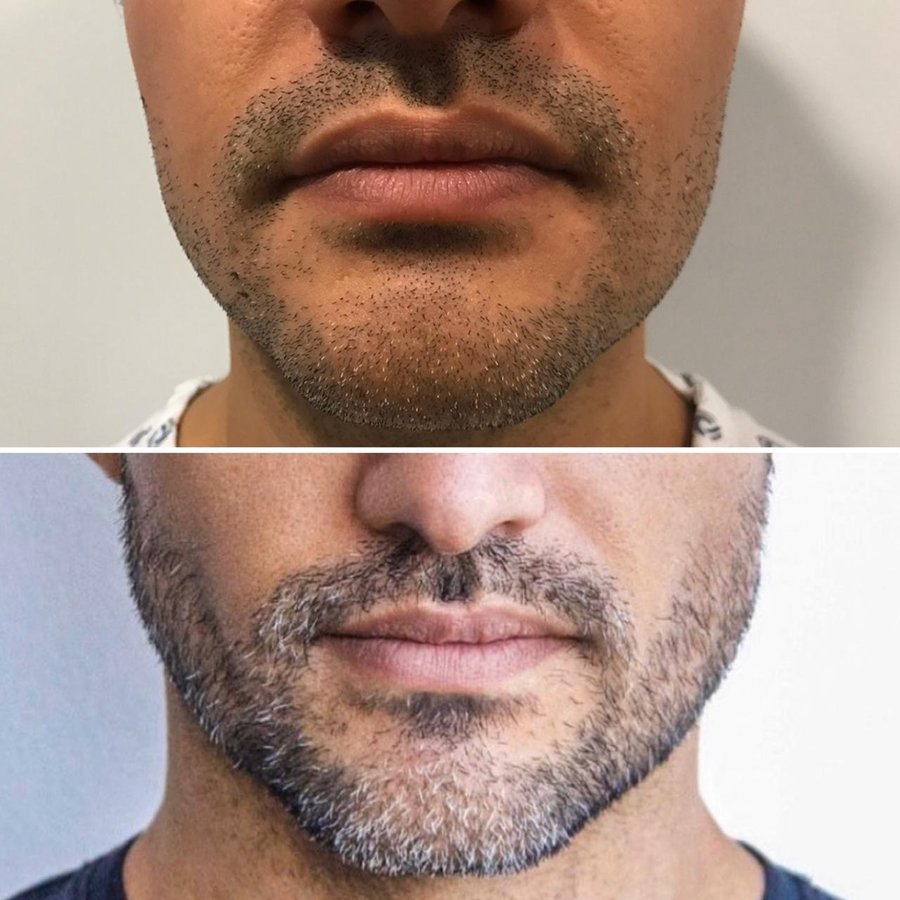 MX Capilar Tijuana - MX Capilar Tijuana