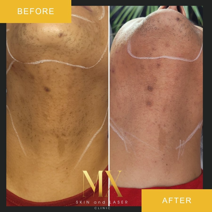 MX Skin and Laser Clinic - MX Skin and Laser Clinic